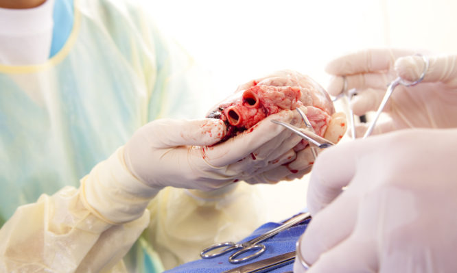 Πραγματοποιήθηκε η πρώτη στον κόσμο μεταμόσχευση καρδιάς σε άνθρωπο από γενετικά τροποποιημένο χοίρο
