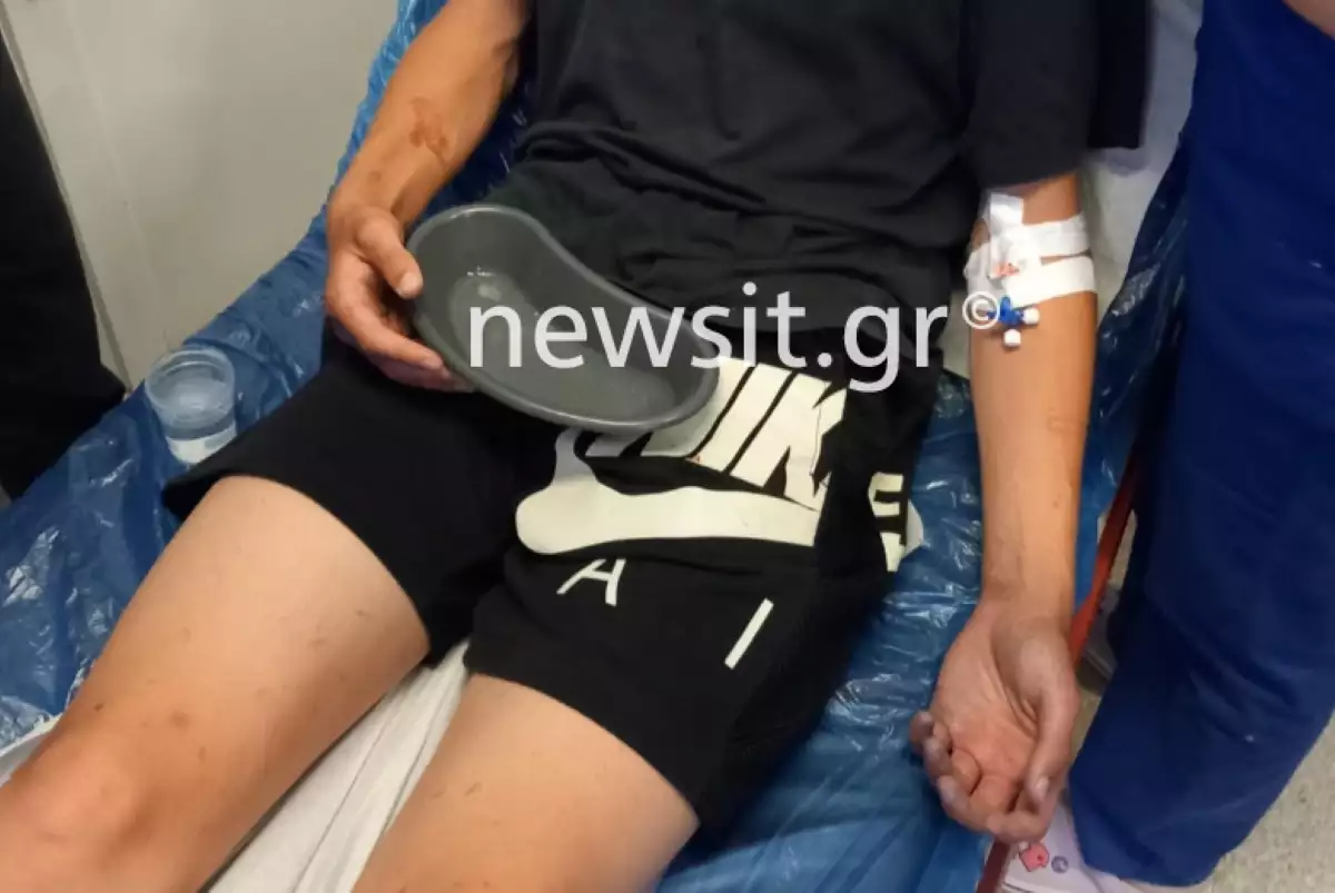 Καλαμάτα: Άγριος ξυλοδαρμός 16χρονου από ανηλίκους Καλαμάτα: Άγριος ξυλοδαρμός 16χρονου από ανηλίκους