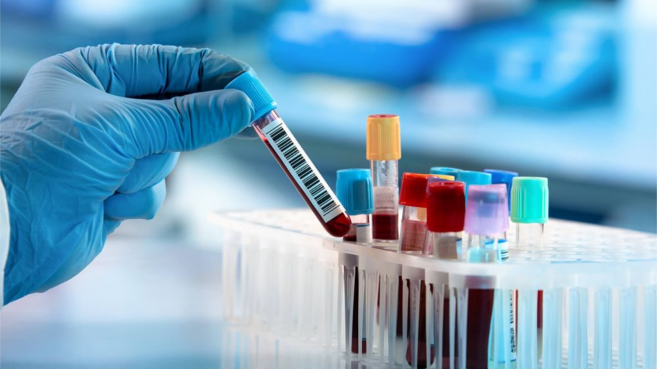 Νέα εξέταση αίματος ανιχνεύει τρεις από τους πιο θανατηφόρους τύπους καρκίνου
