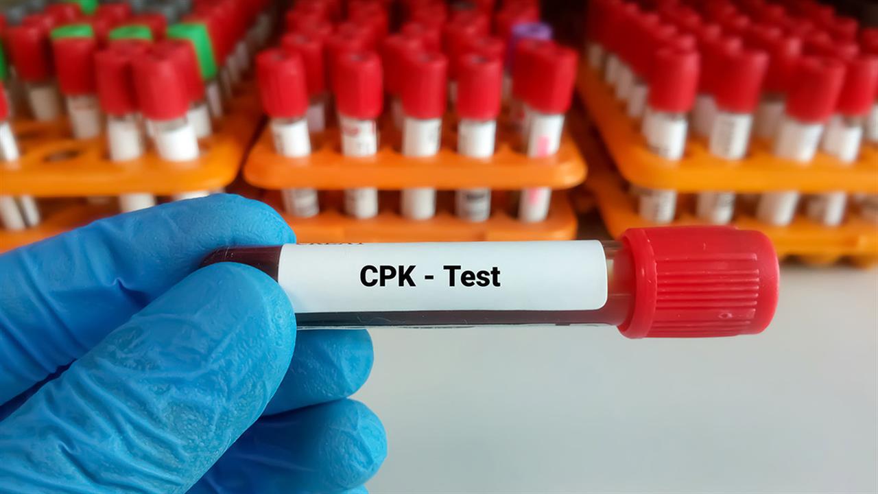 Αυξημένη CPK στο αίμα: Τι είναι και τι σημαίνει για την υγεία μας Αυξημένη CPK στο αίμα: Τι είναι και τι σημαίνει για την υγεία μας