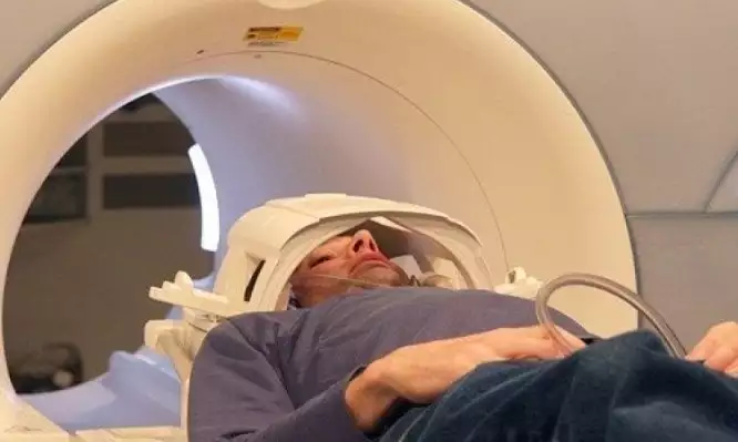 Επιστήμονες δημιούργησαν τεστ που προβλέπει την άνοια 9 χρόνια πριν από τα πρώτα συμπτώματα Επιστήμονες δημιούργησαν τεστ που προβλέπει την άνοια 9 χρόνια πριν από τα πρώτα συμπτώματα