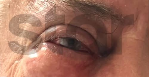 Eπιχειρηματίας από την Κομοτηνή κατήγγειλε ξυλοδαρμό από πρώην συνέταιρό του μέσα σε εστιατόριο Eπιχειρηματίας από την Κομοτηνή κατήγγειλε ξυλοδαρμό από πρώην συνέταιρό του μέσα σε εστιατόριο